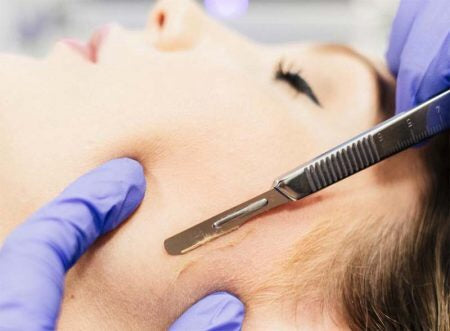 Derma-planing/add on